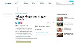 
                            10. Trigger Finger: Causes, Symptoms, Treatment, and Surgery - WebMD