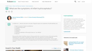 
                            11. What are the symptoms of infant hydrocephalus? - Sharecare