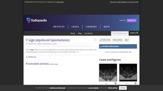 
                            13. Y sign (epidural lipomatosis) | Radiology Reference Article ...