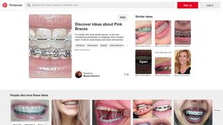 ArchWired: A website for adults with dental braces and retainers on ...