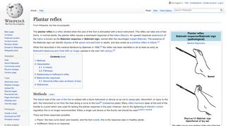 Plantar reflex - Wikipedia