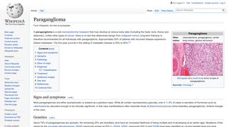 Paraganglioma - Wikipedia