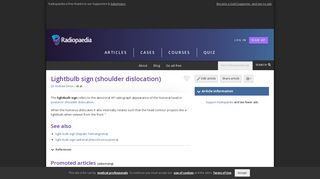 Lightbulb sign (shoulder dislocation) | Radiology Reference Article ...