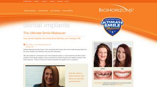Dear Doctor Ultimate Smile Makeover - BioHorizons