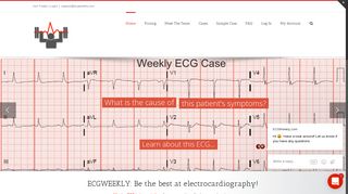 ECG Weekly – Learn ECGs One Week at a Time