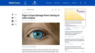 Signs of eye damage from staring at solar eclipse - Medical Xpress