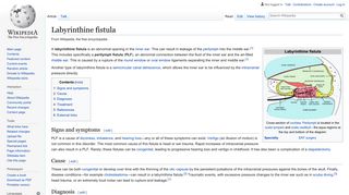 Labyrinthine fistula - Wikipedia
