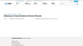 Uterine Fibroid Pictures: Anatomy Diagrams, Pictures of Fibroids ...