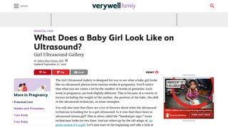 What Does a Baby Girl Look Like on Ultrasound? - Verywell Family