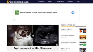 Difference Between Boy Ultrasound vs. Girl Ultrasound – Difference Wiki