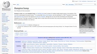 Hampton hump - Wikipedia