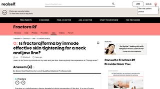 Is fractora/forma by inmode effective skin tightening for a neck ...
