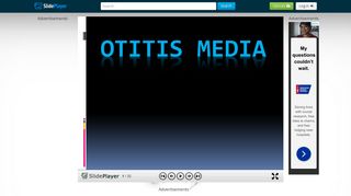 Otitis Media. - ppt download - SlidePlayer