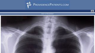 Pneumonia - Having Surgery at Providence/Providence Park Hospital?