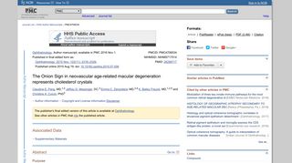 The Onion Sign in neovascular age-related macular ... - NCBI - NIH