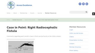 Case in Point: Right Radiocephalic Fistula