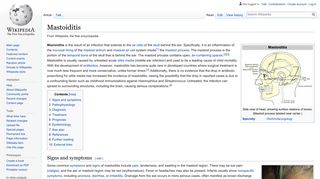 Mastoiditis - Wikipedia