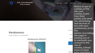 Keratoconus – Dr. Carlo Benedetti