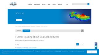 Learn More SCiLS lab software - SCiLS | Bruker