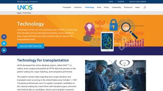 UNet system changes | Transplant Pro