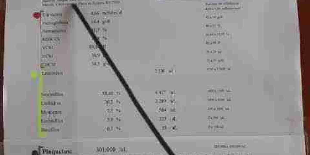 Interpretación del hemograma: introducción, leucocitos, eritrocitos, plaquetas