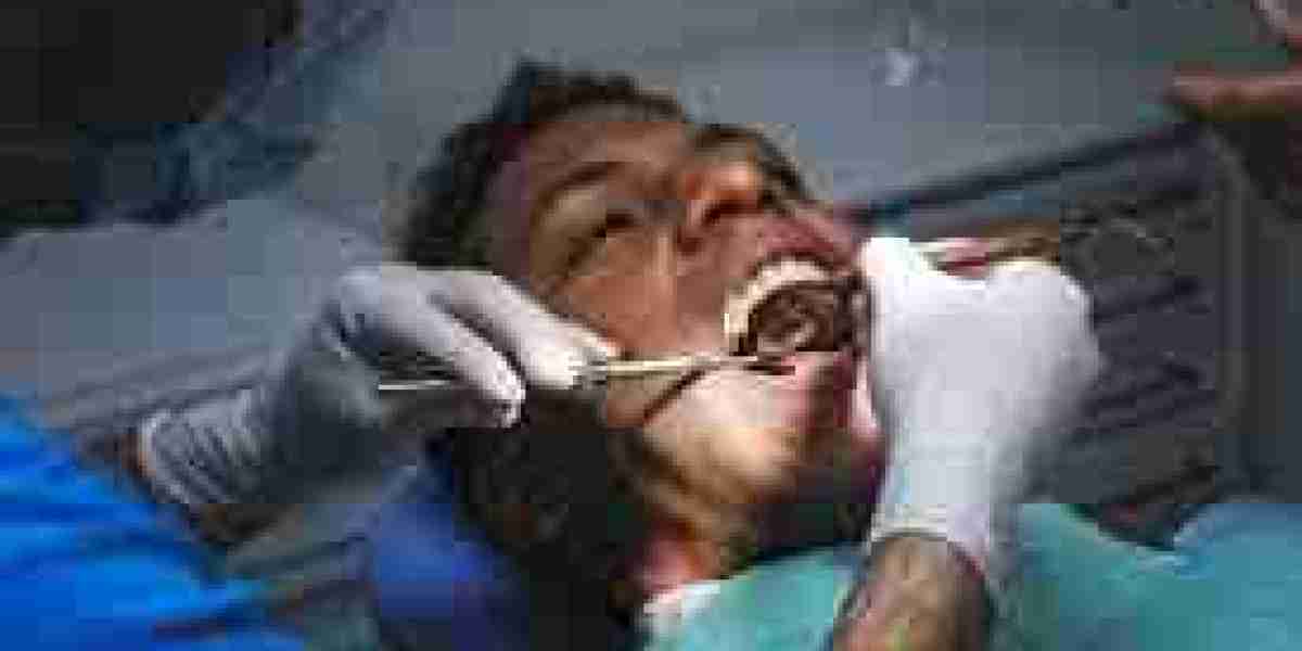 Understanding the Expenses of Wisdom Teeth Extraction