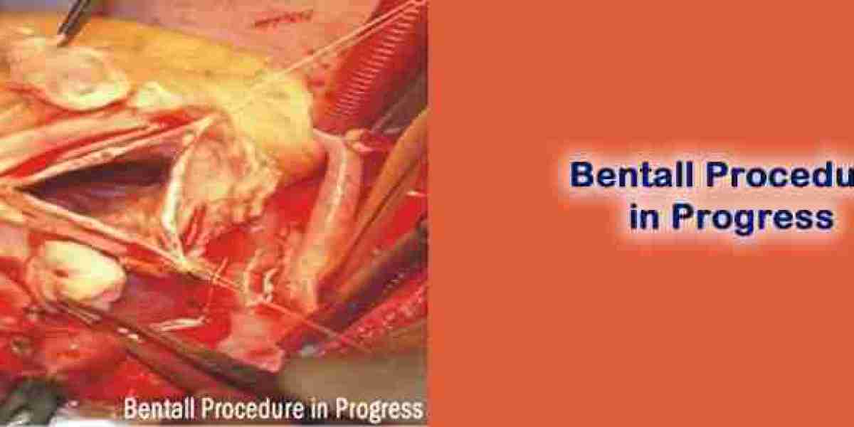 Bentall Procedure in India – Advanced Life-Saving Aortic Root Surgery