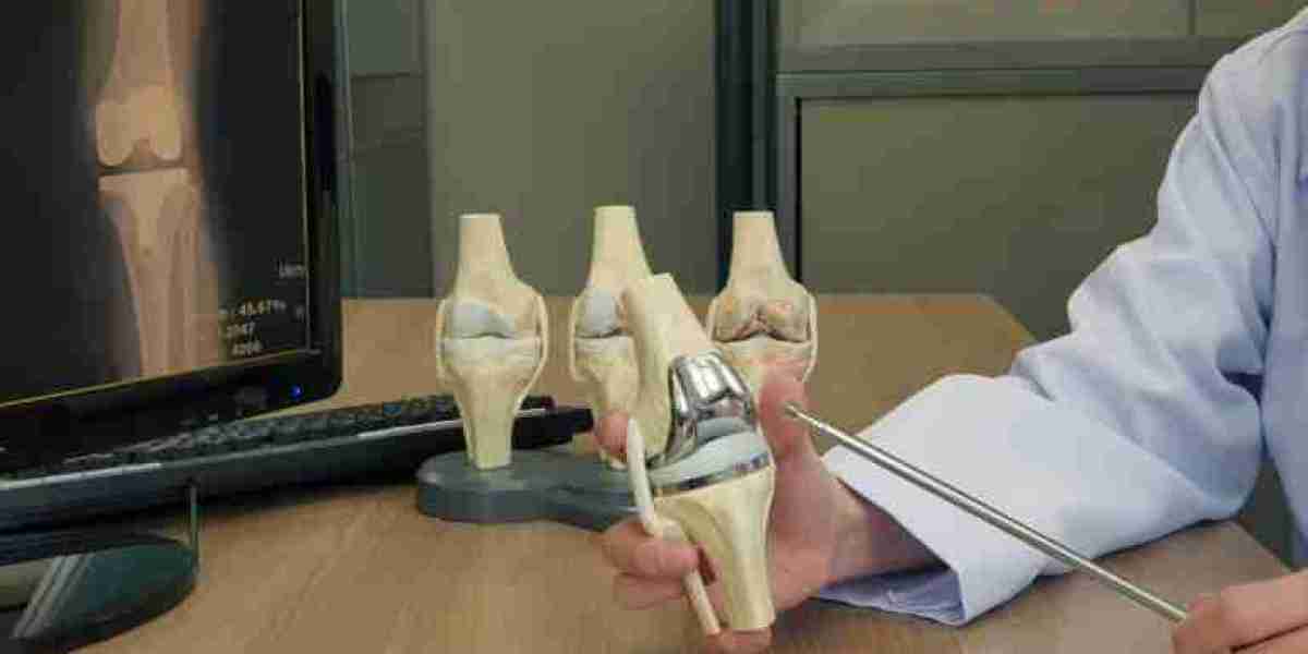 Best Knee Replacement Surgeons in India – Comprehensive Guide for Patients