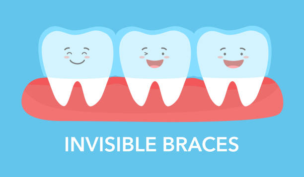Can Invisalign Improve More Than Just Your Smile? – Telegraph