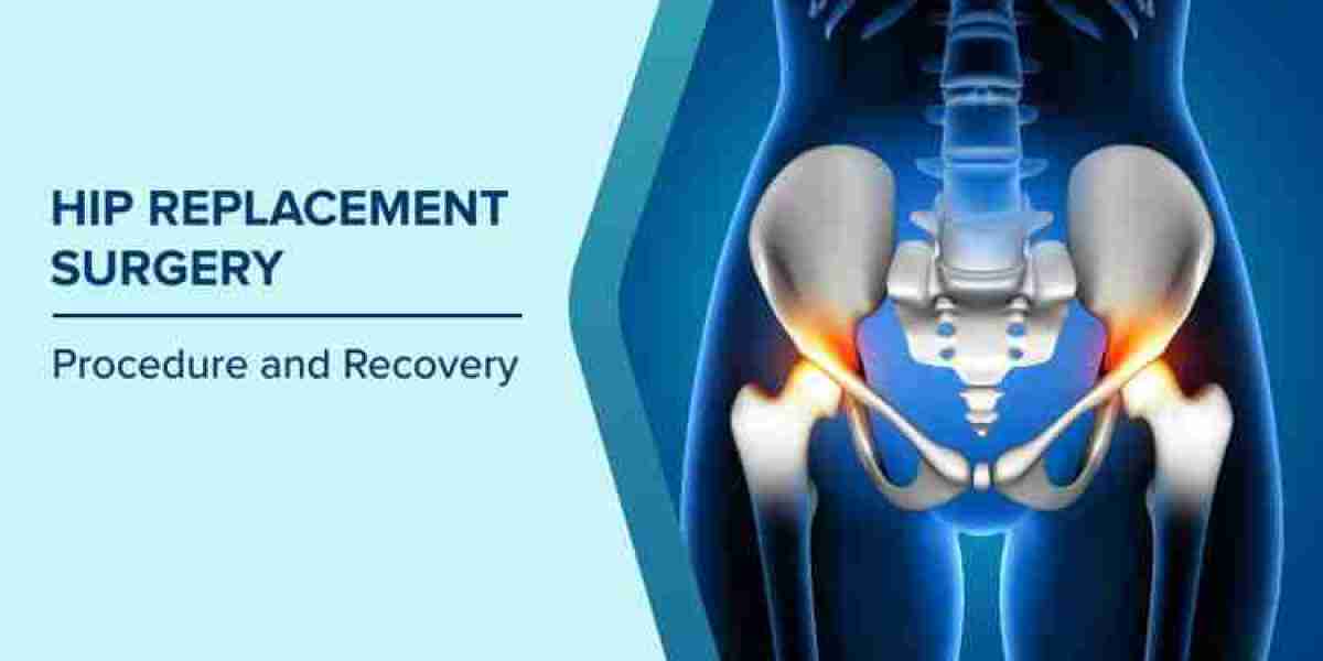 Hip Replacement Cost in India – Comprehensive Guide to Affordable & Advanced Hip Replacement Surgery