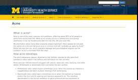 
							         Acne | University Health Service								  
							    