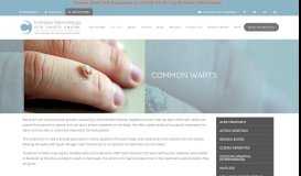 
							         Common Warts - Treatment and Removal | Cahaba Dermatology								  
							    