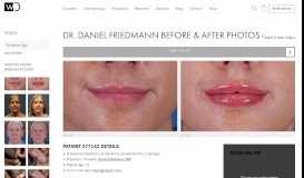 
							         Dr. Daniel Friedmann Cases - Westlake Dermatology								  
							    