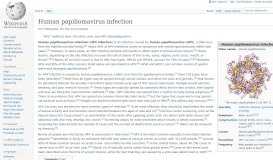 
							         Human papillomavirus infection - Wikipedia								  
							    