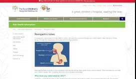 
							         Kids Health Info : Nasogastric tubes - The Royal Children's Hospital								  
							    