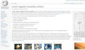 
							         Lower segment Caesarean section - Wikipedia								  
							    