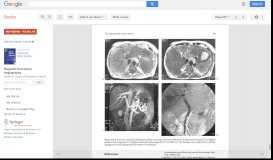 
							         Magnetic Resonance Angiography								  
							    