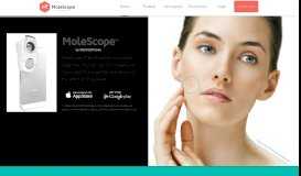 
							         MoleScope™ | Skin screening made simple								  
							    