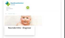 
							         Neurodermitis Diagnose - Das Hautkrankheiten Portal								  
							    