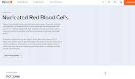 
							         Nucleated Red Blood Cells - Glossary | Laboratory, radiology, sleep ...								  
							    