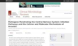 
							         Pathogens Penetrating the Central Nervous System: Infection ...								  
							    