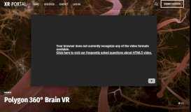 
							         Polygon 360° Brain VR – XR Portal								  
							    