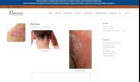 
							         Psoriasis - Rencic Dermatology								  
							    