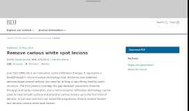 
							         Remove carious white spot lesions | British Dental Journal - Nature								  
							    