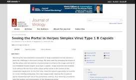 
							         Seeing the Portal in Herpes Simplex Virus Type 1 B Capsids | Journal ...								  
							    