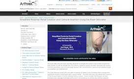 
							         Simplified Posterior Portal Creation and Cannula Insertion ... - Arthrex								  
							    