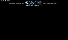 
							         The Cancer Imaging Archive (TCIA) - A growing archive of medical ...								  
							    