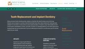 
							         Tooth Replacement — West Portal Dental Care								  
							    
