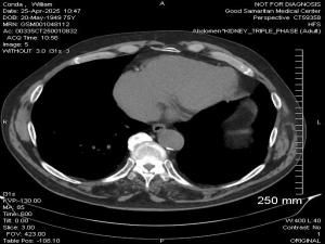 MLS #RX-11095588 img 0