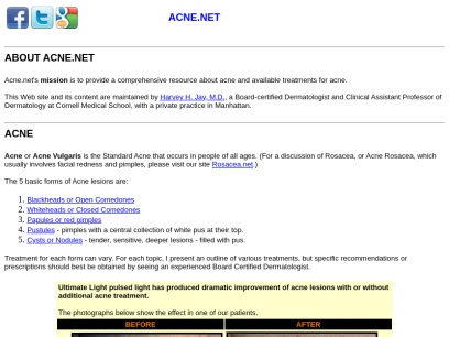 acne.net.png